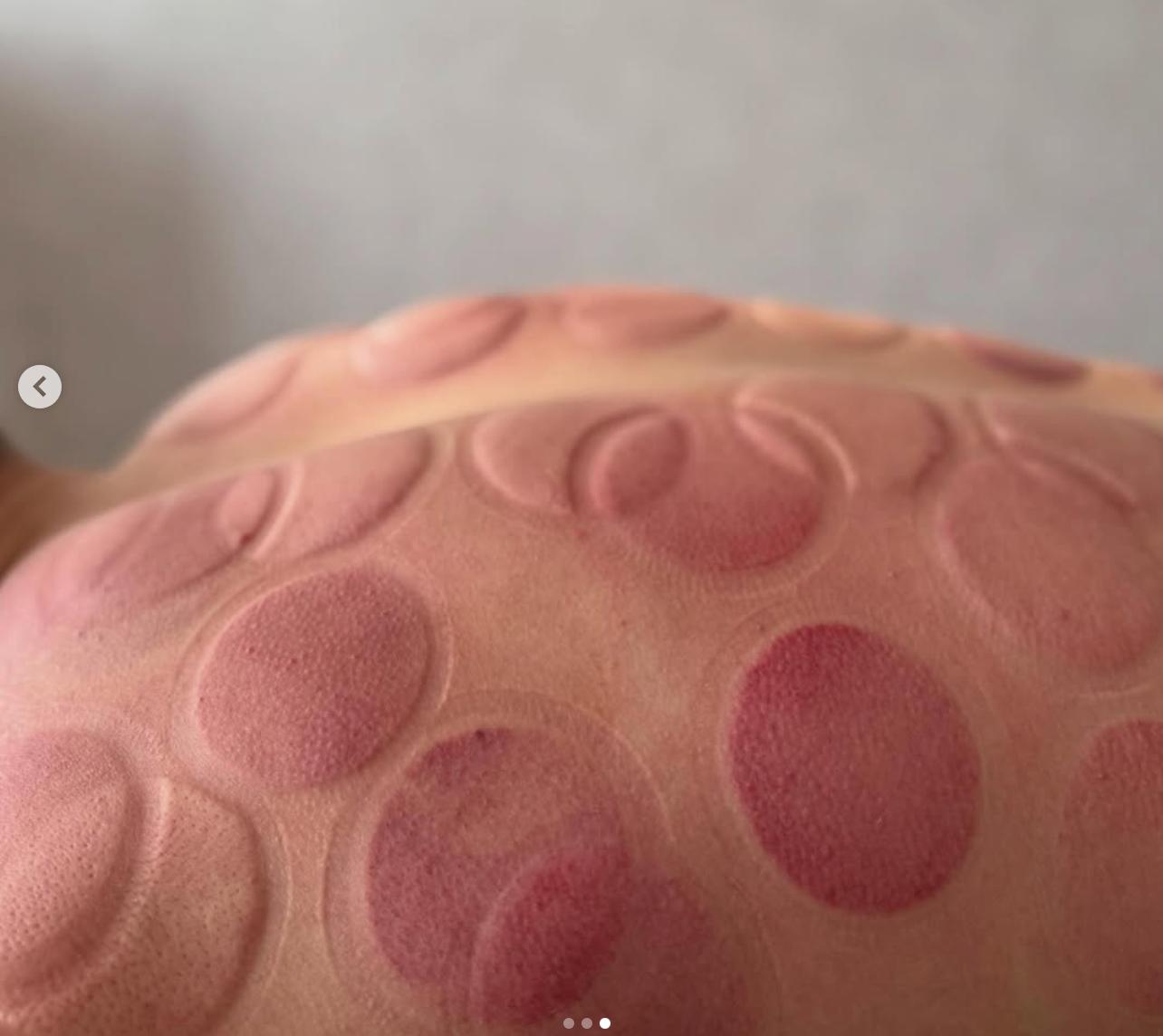 После массажа